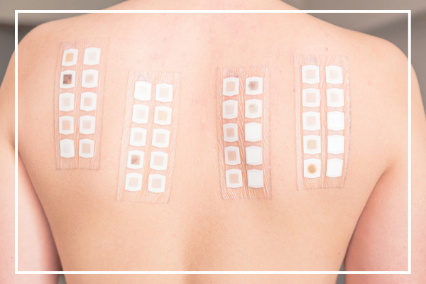 allergy doctor pretoria