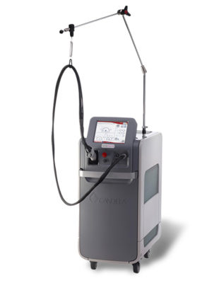 Candela Hair Removal Pretoria